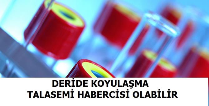 DERİDE KOYULAŞMA TALASEMİ HABERCİSİ OLABİLİR