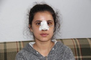 Uyuşturucu Bağımlısı, 13 Yaşındaki Kızın Burnunu Kırdı