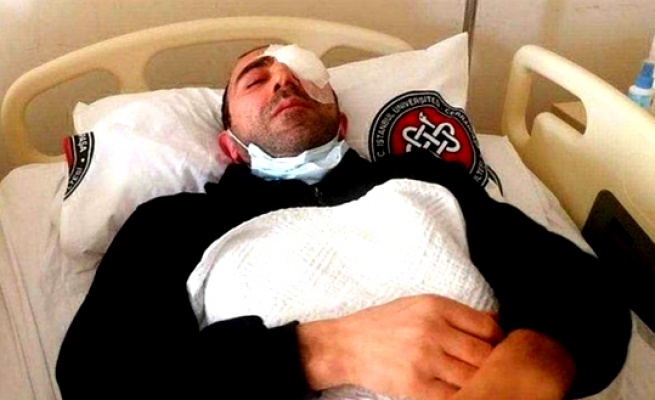 Avcılar Belediyesi çalışanına saldırı